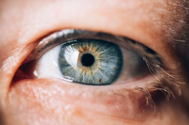 Unveiling the Mystery: Understanding Eye Discoloring and What it Indicates
