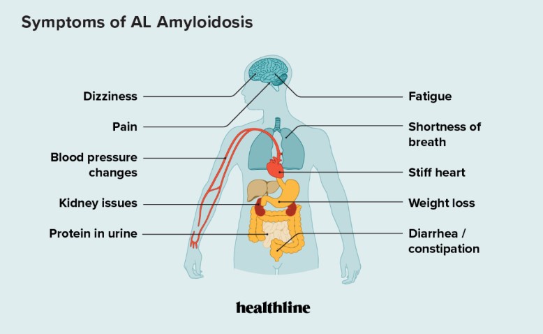 Understanding Amyloidosis: Causes, Symptoms, and Treatments
